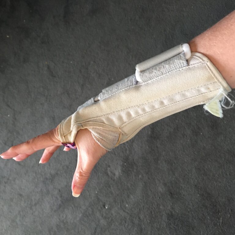 Ganglion Cyst Removal / Excision Recovery Pictures Jenny Smith