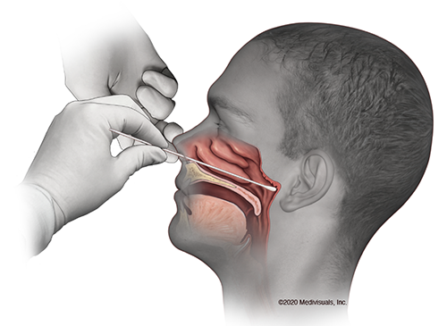 77AA217F C2F1 431A BC9B 9E2A1891EE8E Astra Zeneca vaccine study